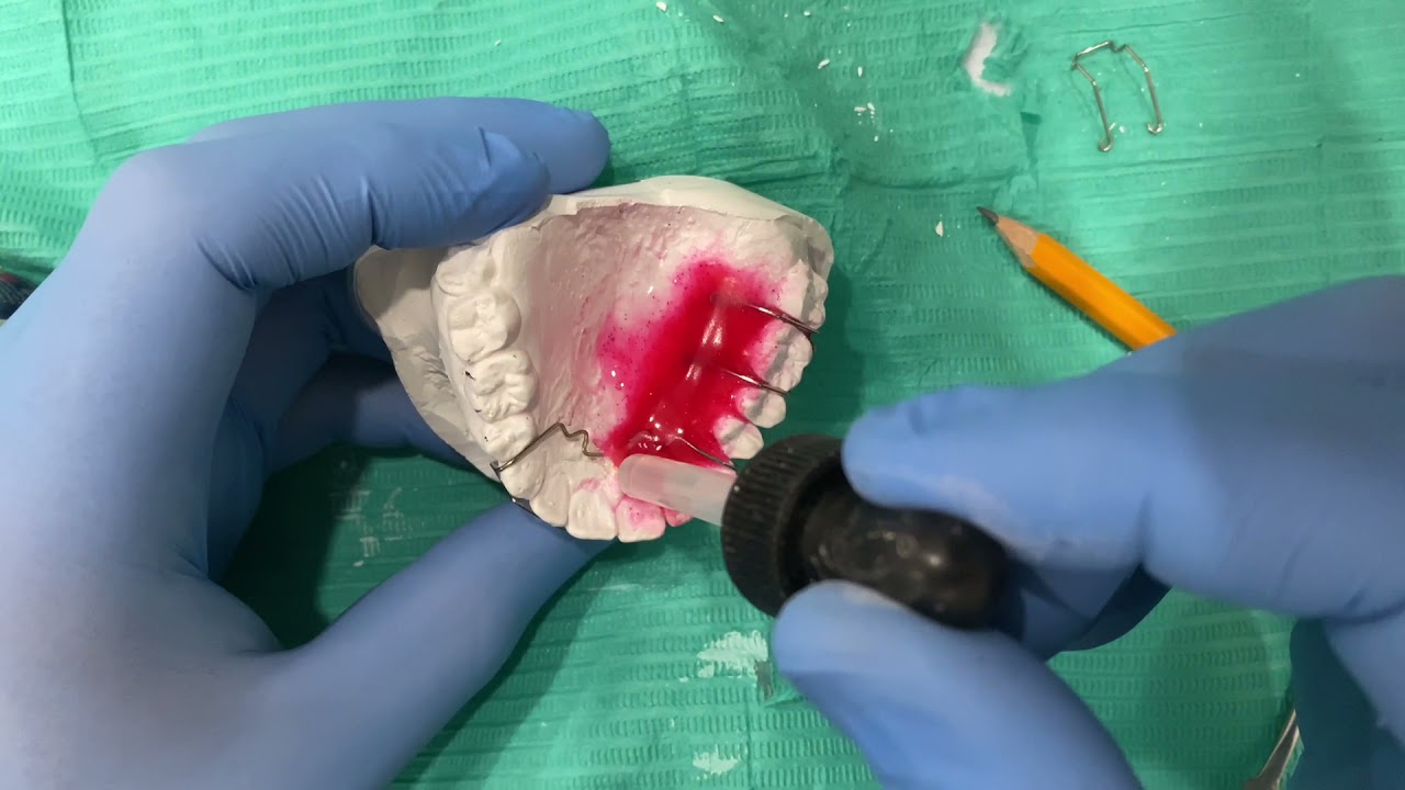 Acrilizado de Placa Hawley