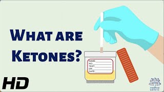 What Are Ketones and Why Are They So Important for Your Health?