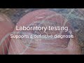 BakoDx Testing for Your Onychodystrophy Patients