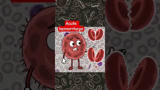 Causes of Normocytic Normochromic Anemia #pathology #pathologyviva