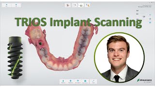 3shape TRIOS - Straumann Implant Scanning Workflow