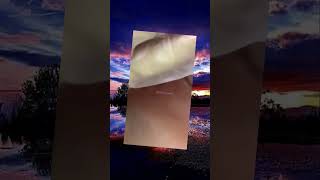 Blackheads Removal | Acne Treatment and Very Satisfying Satisfying Pimple pop #blackheads