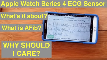 Apple Watch Series 4+ ECG: Electrocardiograms & Atrial Fibrillation (AFib)