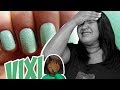 BOLINNHA NO ESMALTE: O QUÊ FAZER?