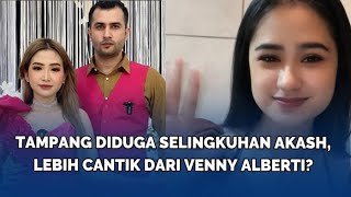 Tampang Diduga Selingkuhan Akash, Lebih Cantik dari Venny Alberti?