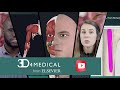 Welcome to the 3d4medical youtube channel