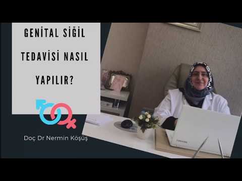 Genital Siğil Tedavisi Nasıl Yapılır?