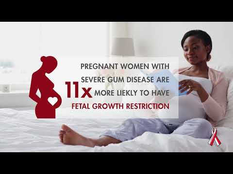 Poliklinika Harni - Periodontalne bolesti trudnice i fetalni rast