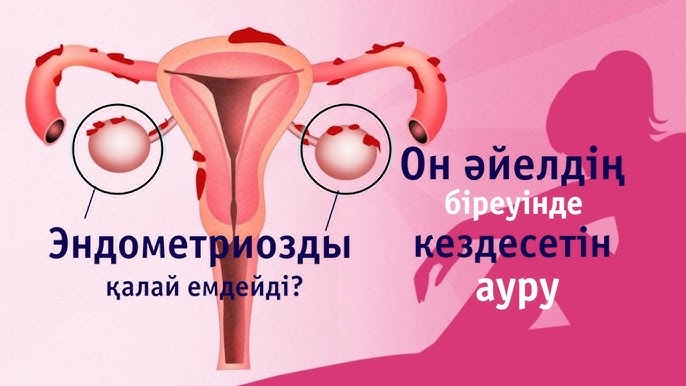 Есектің жеке фотосы