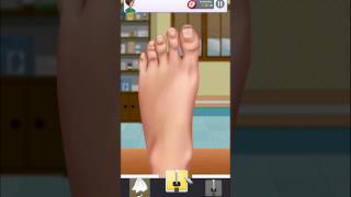 asmr fungal nail treatment animation youtubeshorts trendingshorts viralvideo shortvideo