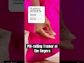 Pill-rolling Tremors of the fingers.#nurses #nursing #nursingstudent #neet #norcet #aiims #ytshorts