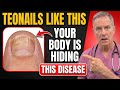 If Your TOENAILS Look Like THIS After 60, Your Body May Be Hiding 4 Problems