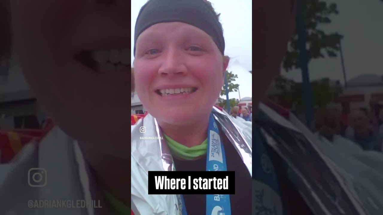 Weight loss transformation #gastricbypass #carnivore #glp1forweightloss #exercise