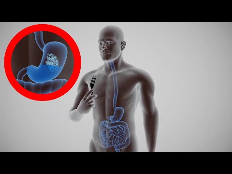 Video: În ce organ se amestecă Chyme cu suc pancreatic și bilă?