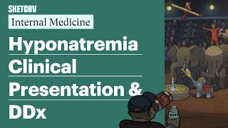 Hyponatremia: Clinical Presentation & DDx (Internal Medicine) | Sketchy Medical