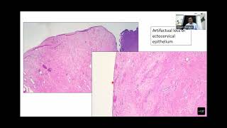 ARTIFACT IN HISTOLOGY screenshot 4