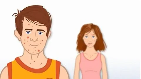 Acne – What boys can do about it - DayDayNews