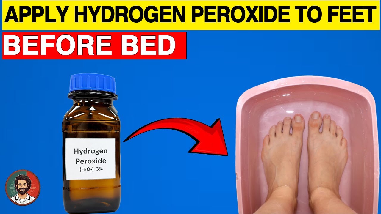 Hydrogen Peroxide: The Secret Healer for Your Feet