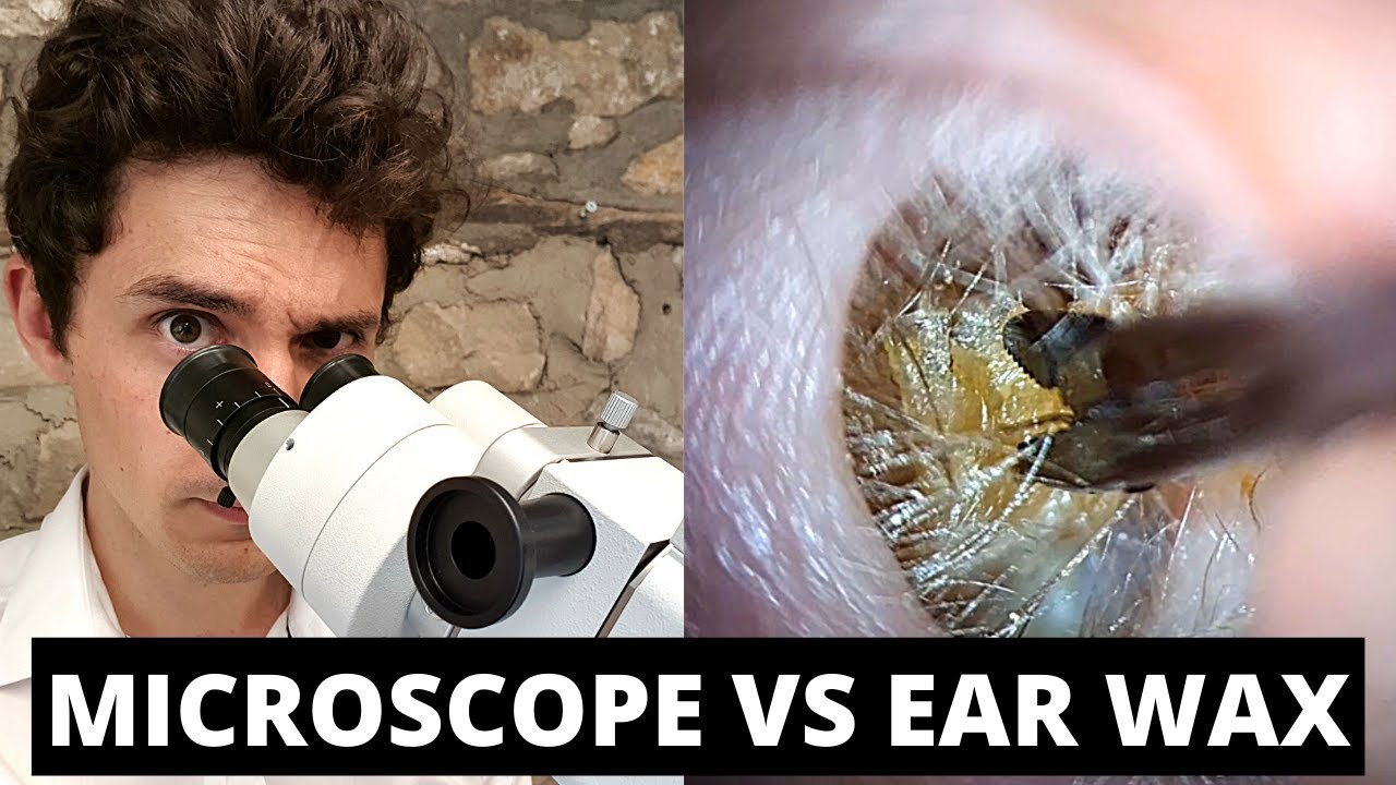 Microscope VS Ear Wax YouTube