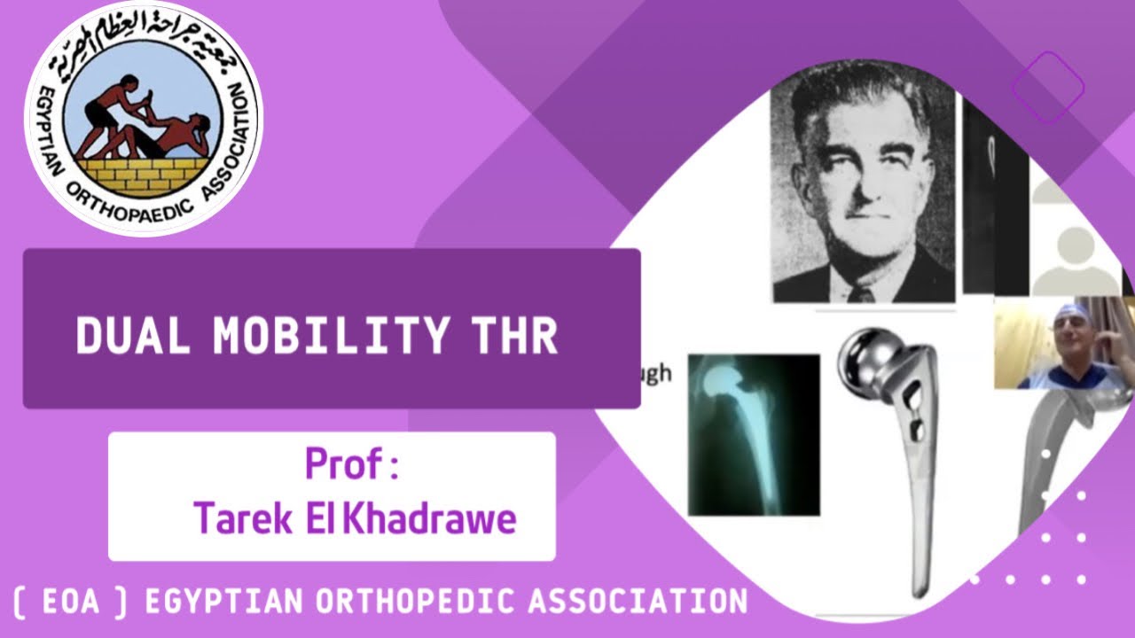 dual-mobility-thr-prof-tarek-el-khadrawe-youtube