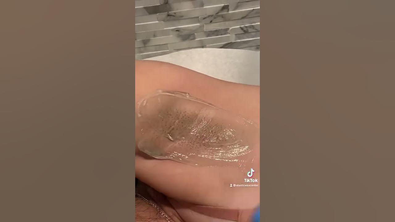 Laser hair removal of the underarms 🥰 #satisfying #satisfyingvideo #hairremoval