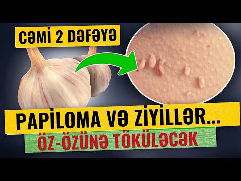 Video: Solikamsk maqnezium zavodu: tarix və məhsullar