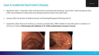 Session 2 Case 4_Incidental Illeal Crohn's