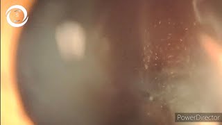 tobacco dust eye seen in Tobacco Dust CC64