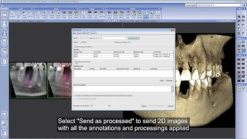 Exporting and importing images with Planmeca Romexis® Cloud