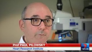 Brain discovery raises Epilepsy drug hopes