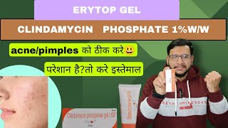 Erytop Gel एक ऐस Antibiotic Cream ज Acnepimples क ठक कर