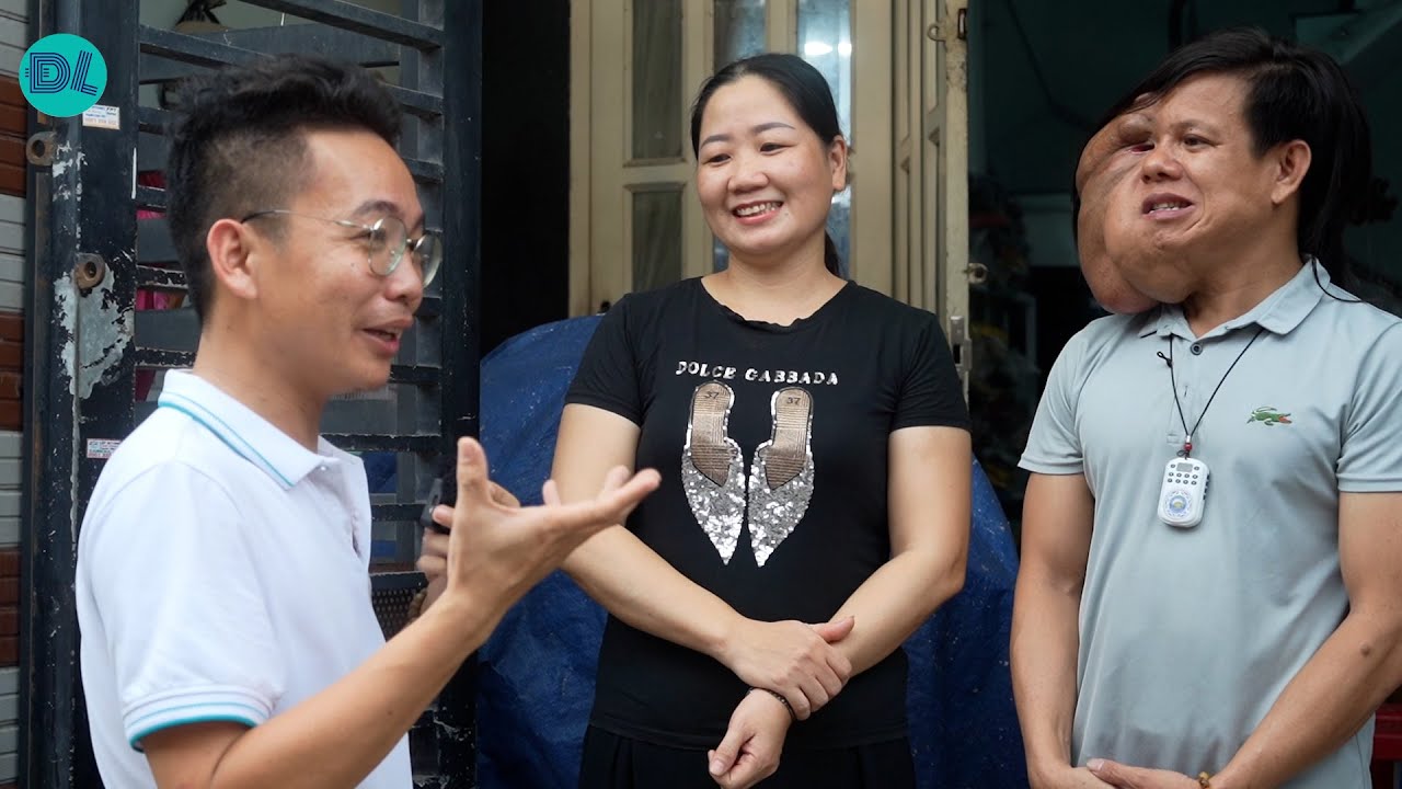 Phép màu đến với người đàn ông có khuôn mặt kỳ lạ và cô vợ xinh - ĐỘC LẠ BÌNH DƯƠNG