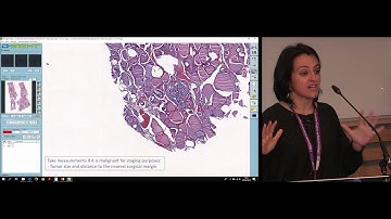 ECDP 2019 | Digital Thyroid Pathology