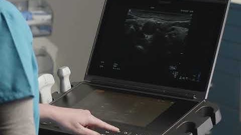 Sonosite PX Help Video - Adding Patient Information