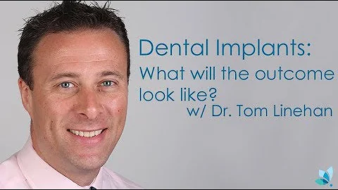 Dental Implants - What will the Outcome Look Like?...