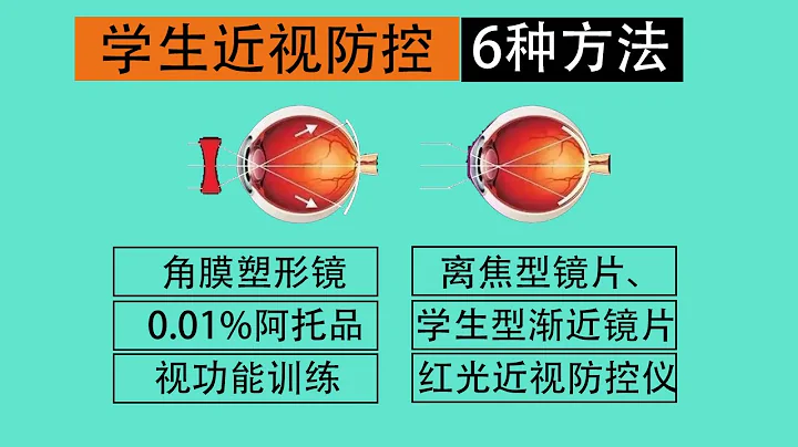 學生近視防控6種方法分析，蔡司成長樂、豪雅新樂學、OK角膜塑形鏡、學生鏡 - 天天要聞