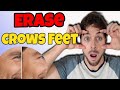 Get Rid Of Crows Feet | Skincare Products That Acutally Work | Chris Gibson