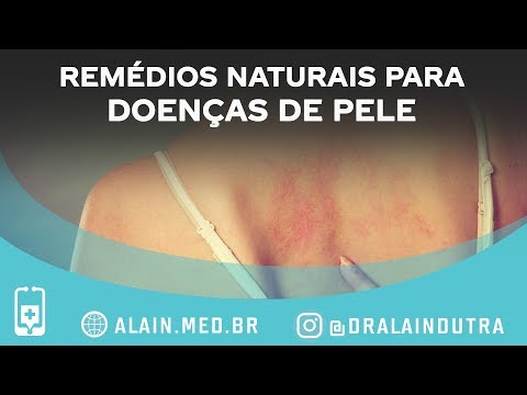 Remédios naturais para doenças de pele que funcionam