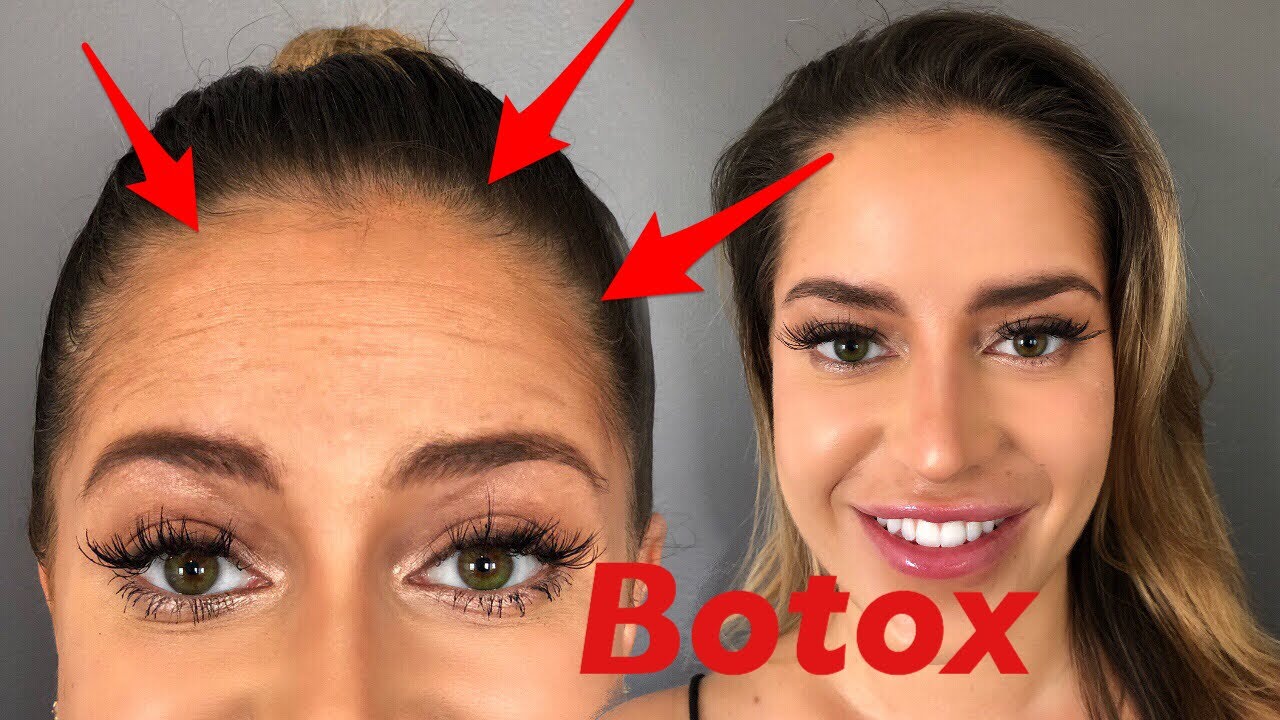 Where To Get Botox To Look Younger
