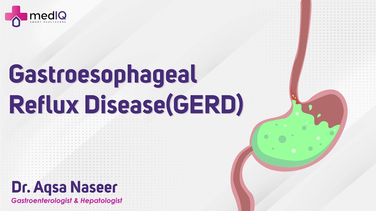 Gastroesophageal Reflux Disease (GERD) | Dr Aqsa Naseer | Hindi/Urdu