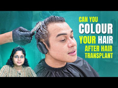 Transplant के बाद Hair Color करना सही है या नहीं? 🤔 | Hair Care Tips | Hindi