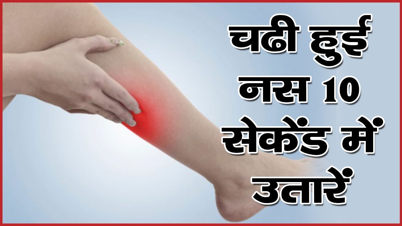 चढ़ी हुई नस 10 सेकेंड में ऐसे उतारें || Home Remedies For Nerves Blockage In Hindi