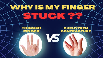 Causes of a Stuck Finger : Trigger finger vs Dupuytren
