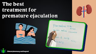 How to treat premature ejaculation?