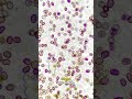 Mushroom Spores Through A HIGH POWERED MICROSCOPE 