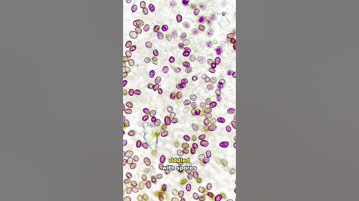 Mushroom spores through a HIGH POWERED MICROSCOPE!