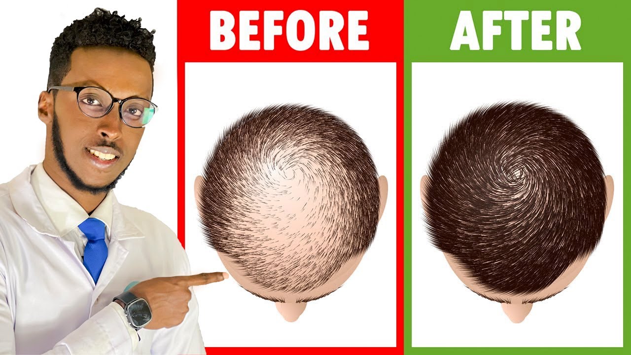 TIMO DAADASHADA IYO SIDA LOO DAAWEEYO | XALKA BIDAARTA