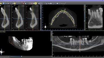 Where are the Projection Lines?