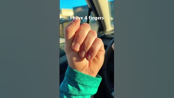 I only have 4 fingers. #shorts #waitforend #funny #hand