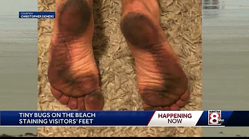 Beach bugs are staining people's feet in Maine